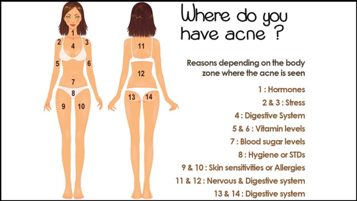 Acne and Health