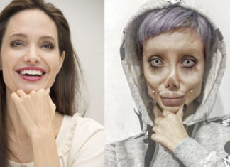 Sahar Tabar’s Angelina Jolie Surgery Was A Hoax