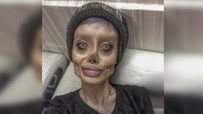 Woman Undergoes Over 50 Surgeries To Look Like Angelina Jolie And Here’s How She Looks Like!